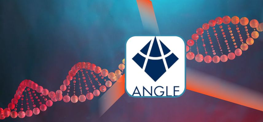 Angle Signs Commercial Agreement with Large Pharma